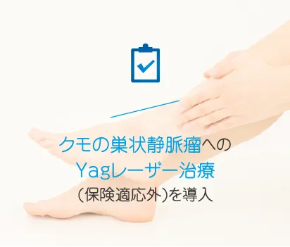 クモの巣静脈瘤へのYagレーザー治療（保険適応外）を導入