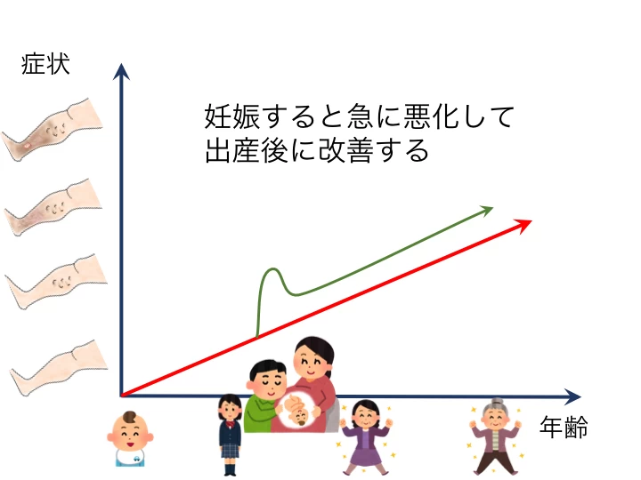 妊娠すると急に悪化する